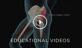 patient  education Video